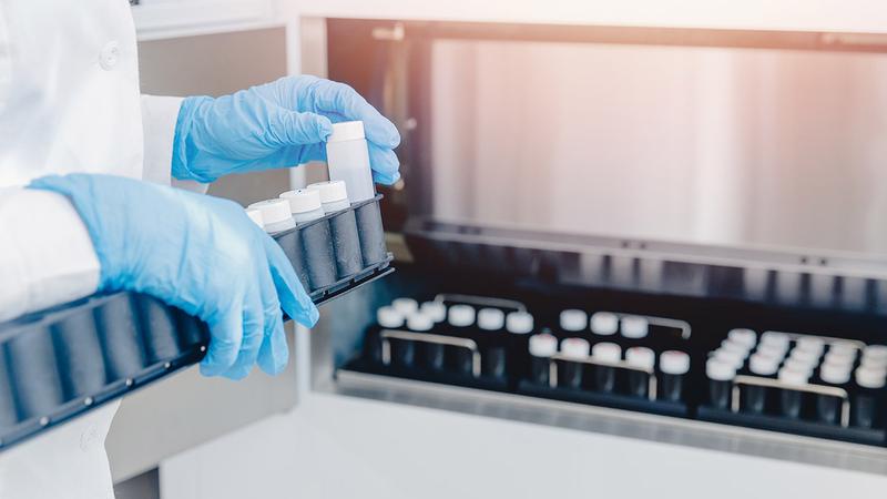 Zarobki w banku spermy